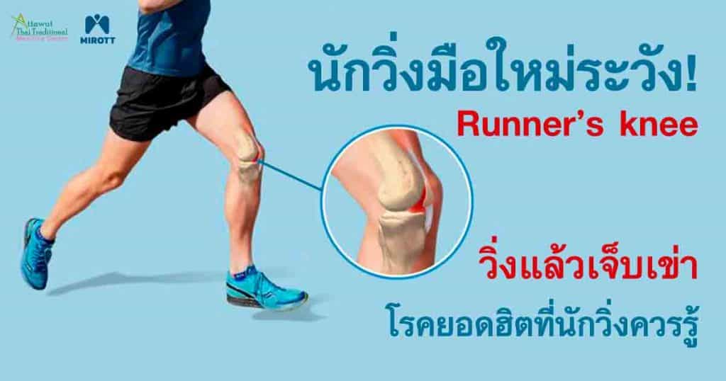 นักวิ่งมือใหม่ระวัง! Runner’s knee วิ่งแล้วเจ็บเข่า โรคยอดฮิตที่นักวิ่งควรรู้